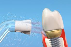 ¡DILE ADIÓS AL HILO DENTAL TRADICIONAL Y DESCUBRE UNA LIMPIEZA PROFESIONAL! 🦷✨